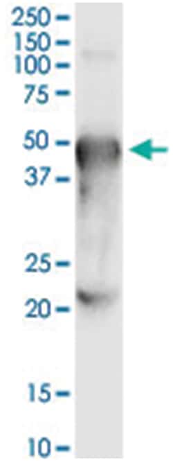 anti-PORCN, Human, IP-WB Antibody Pair, Abnova&trade;