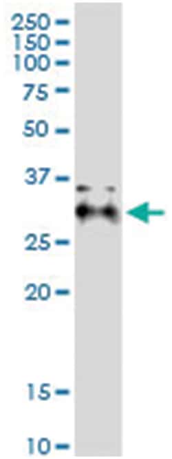 anti-AIDA, Human, IP-WB Antibody Pair, Abnova&trade;