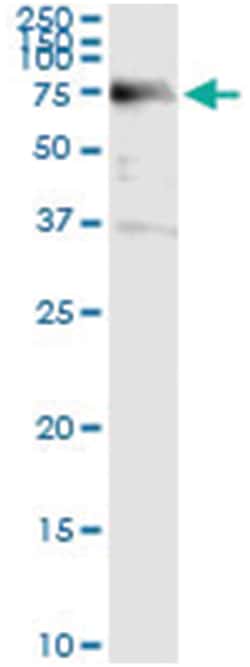 ACD, Human, IP-WB Antibody Pair (PW1), Abnova&trade;