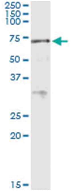 ACD, Human, IP-WB Antibody Pair (PW2), Abnova&trade;