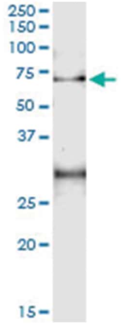 ACD, Human, IP-WB Antibody Pair (PW3), Abnova&trade;