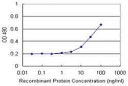 NADK, Human, Matched Antibody Pair (AP21), Abnova&trade;