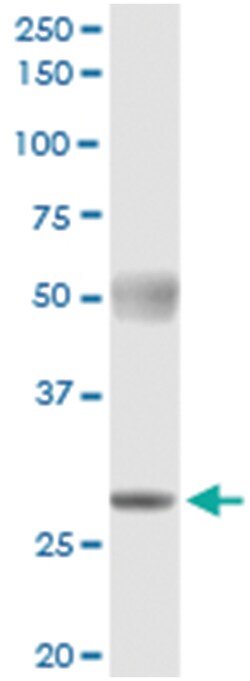PYCRL, Human, IP-WB Antibody Pair (PW2), Abnova 1 Set:Antibodies, Monoclonal/Polyclonal