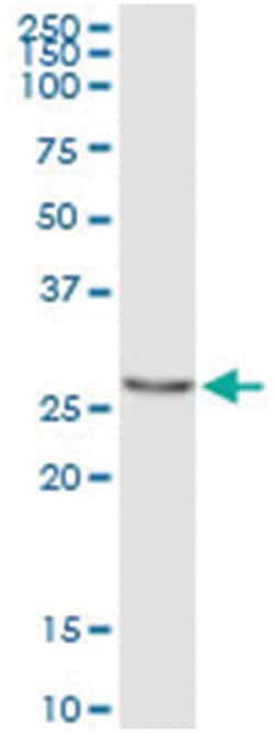 PYCRL, Human, IP-WB Antibody Pair (PW3), Abnova&trade;