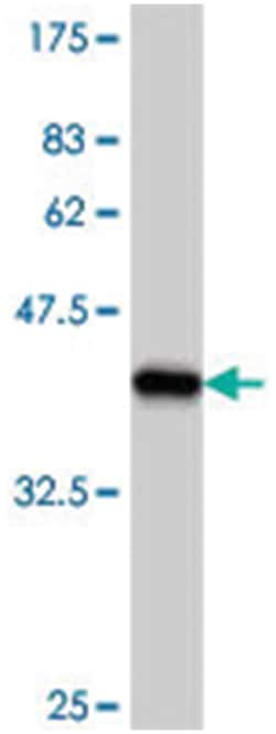 WNK3, Mouse, Polyclonal Antibody, Abnova 50&mu;L; Unlabeled:Antibodies,