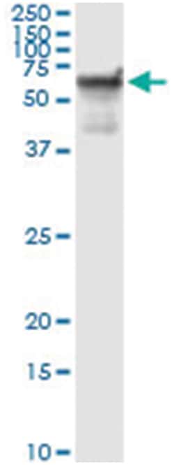 STK33, Human, IP-WB Antibody Pair (PW2), Abnova 1 Set:Antibodies, Monoclonal/Polyclonal