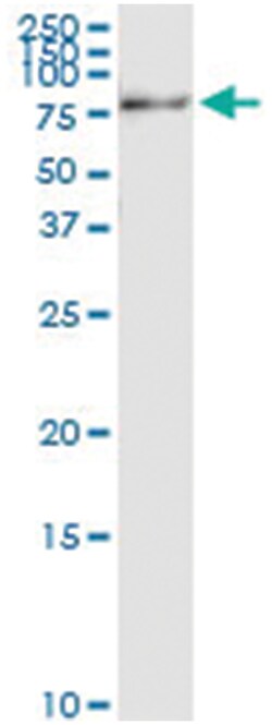 anti-ZSCAN18, Human, IP-WB Antibody Pair, Abnova&trade;