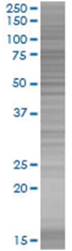 ZNF447 293T Cell Overexpression Lysate (Denatured), Abnova 100 &mu;l | Buy Online | Abnova | Fisher Scientific