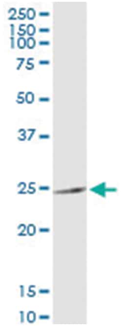 anti-MRPS34, Human, IP-WB Antibody Pair, Abnova&trade;