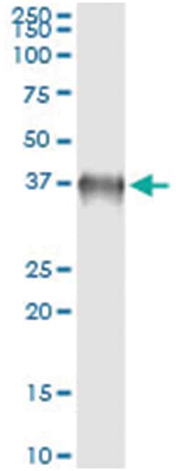 BOLL, Human, IP-WB Antibody Pair (PW2), Abnova&trade;