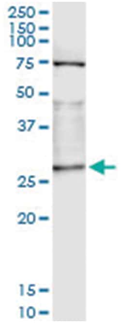 anti-OTUB2, Human, IP-WB Antibody Pair, Abnova&trade;