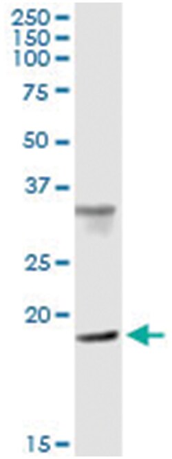 CENPM, Human, IP-WB Antibody Pair (PW3), Abnova 1 Set:Antibodies, Monoclonal/Polyclonal