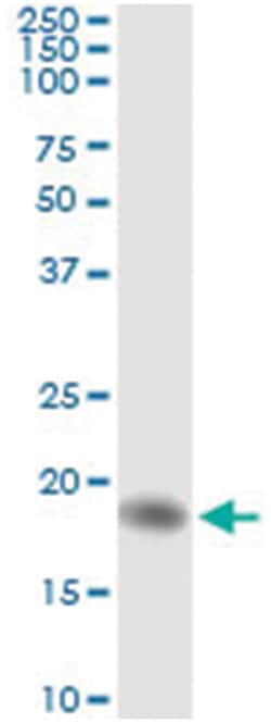 anti-AHNAK, Human, IP-WB Antibody Pair, Abnova 1 Set:Antibodies, Monoclonal/Polyclonal
