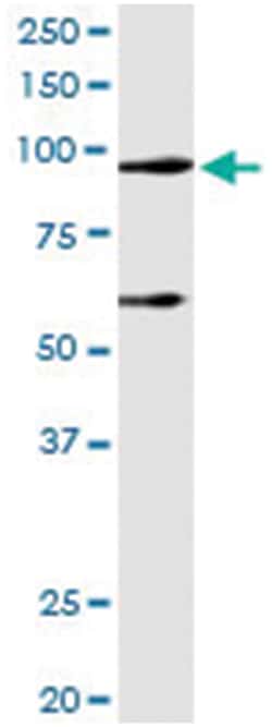 anti-DDX54, Human, IP-WB Antibody Pair, Abnova&trade;