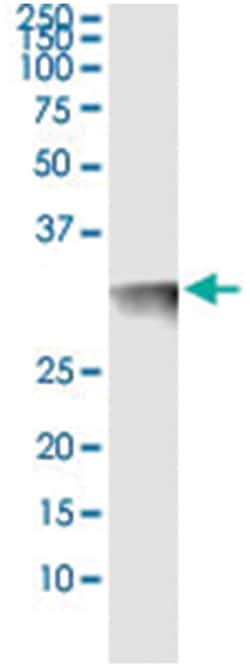 anti-THTPA, Human, IP-WB Antibody Pair, Abnova&trade;