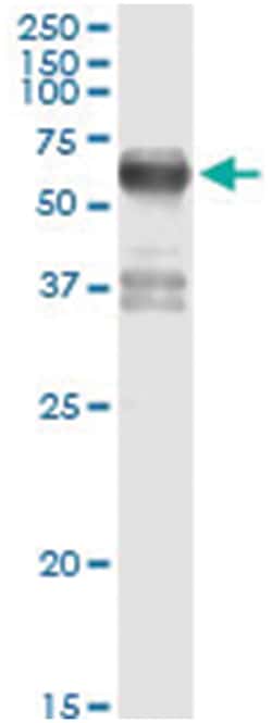 FSD1, Human, IP-WB Antibody Pair (PW1), Abnova&trade;