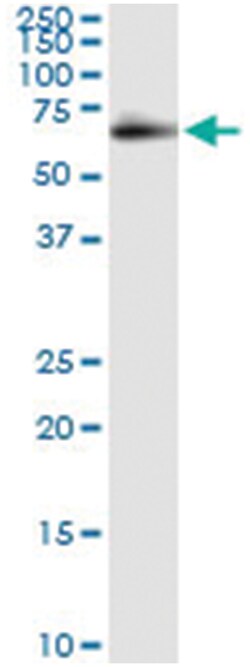 FSD1, Human, IP-WB Antibody Pair (PW2), Abnova&trade;