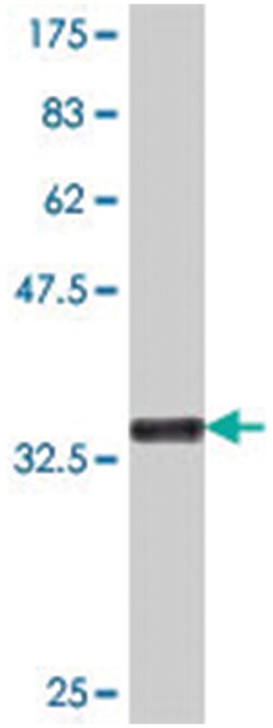 KREMEN2, Mouse, Polyclonal Antibody, Abnova 50 &mu;L | Buy Online | Abnova Corporation | Fisher Scientific
