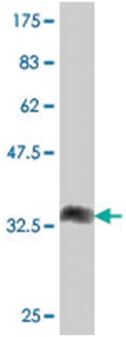 LASS4, Mouse, Polyclonal Antibody, Abnova 50&mu;L; Unlabeled:Antibodies,