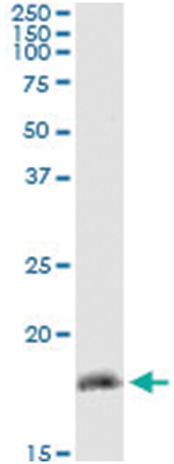 ZMAT4, Human, IP-WB Antibody Pair (PW2), Abnova&trade;