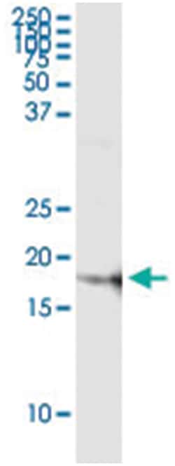 ZMAT4, Human, IP-WB Antibody Pair (PW3), Abnova&trade;
