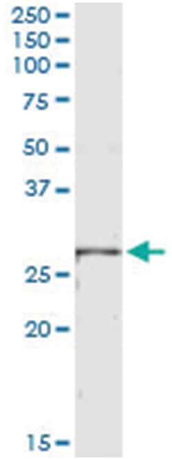 LRRK1, Human, IP-WB Antibody Pair (PW1), Abnova&trade;