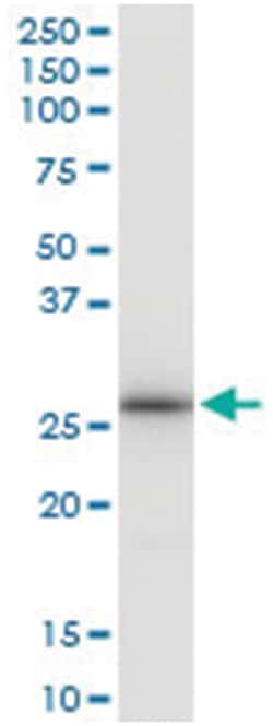 LRRK1, Human, IP-WB Antibody Pair (PW2), Abnova™
