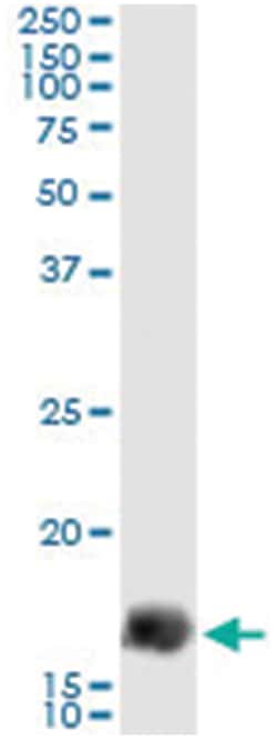anti-GEMIN7, Human, IP-WB Antibody Pair, Abnova 1 Set:Antibodies, Monoclonal/Polyclonal