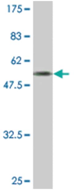 chromosome 15 open reading frame 29, Mouse, Clone: 1E7, Abnova™