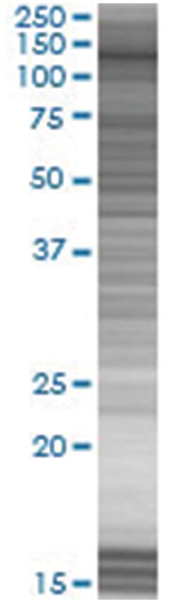 ZNF408 293T Cell Overexpression Lysate (Denatured), Abnova 100 &mu;l | Buy Online | Abnova | Fisher Scientific