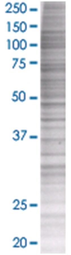 GEMIN6 293T Cell Overexpression Lysate (Denatured), Abnova 100 &mu;L | Buy Online | Abnova | Fisher Scientific