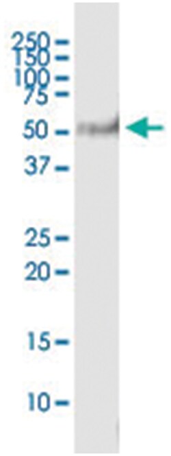 anti-PIP4K2C, Human, IP-WB Antibody Pair, Abnova 1 Set:Antibodies, Monoclonal/Polyclonal