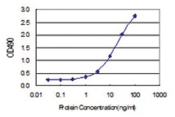anti-NEK11, Human, Matched Antibody Pair, Abnova™