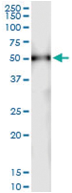 anti-TUBAL3, Human, IP-WB Antibody Pair, Abnova&trade;