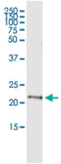 anti-DCAKD, Human, IP-WB Antibody Pair, Abnova&trade;