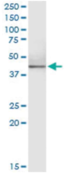 anti-HDAC11, Human, IP-WB Antibody Pair, Abnova&trade;