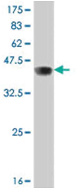 RIN3, Mouse, Polyclonal Antibody, Abnova 50&mu;L; Unlabeled:Antibodies,