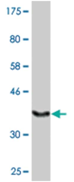 FLJ23577, Mouse, Clone: 4B10, Abnova 200 &mu;L | Buy Online | Abnova | Fisher Scientific