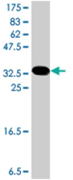 GRHL2, Mouse, Polyclonal Antibody, Abnova 50&mu;L; Unlabeled:Antibodies,