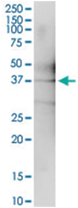 anti-OBFC1, Human, IP-WB Antibody Pair, Abnova 1 Set:Antibodies, Monoclonal/Polyclonal