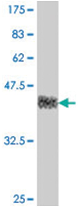 TAIP-2, Mouse, Polyclonal Antibody, Abnova 50&mu;L; Unlabeled:Antibodies,