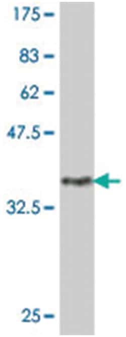 PGAP1, Mouse, Polyclonal Antibody, Abnova 50&mu;L; Unlabeled:Antibodies,