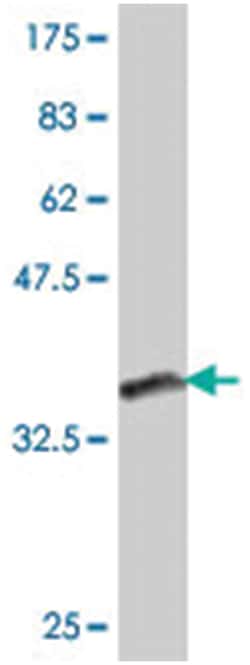 VCPIP1, Mouse, Polyclonal Antibody, Abnova 50&mu;L; Unlabeled:Antibodies,