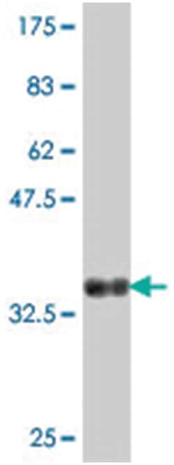 PTGES2, Mouse, Polyclonal Antibody, Abnova 50&mu;L; Unlabeled:Antibodies,