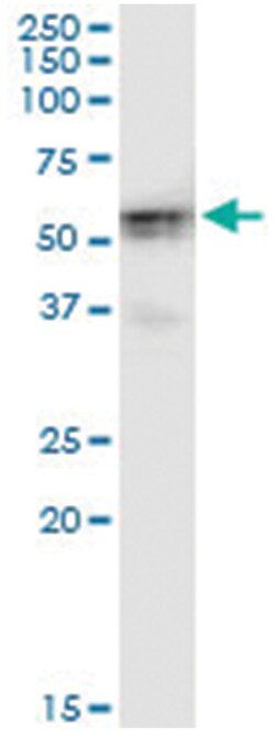 anti-HKDC1, Human, IP-WB Antibody Pair, Abnova 1 Set:Antibodies, Monoclonal/Polyclonal