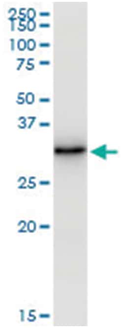 anti-EFHD1, Human, IP-WB Antibody Pair, Abnova 1 Set:Antibodies