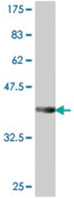 PDGFD, Mouse, Polyclonal Antibody, Abnova 50 &mu;L | Buy Online | Abnova | Fisher Scientific