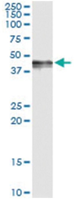 PDGFD, Human, IP-WB Antibody Pair (PW2), Abnova 1 Set:Antibodies, Monoclonal/Polyclonal