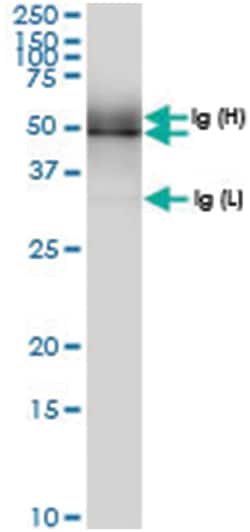 PUS1, Human, IP-WB Antibody Pair (PW1), Abnova&trade;