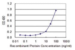anti-COASY, Human, Matched Antibody Pair, Abnova 1 Set:Antibodies, Monoclonal/Polyclonal